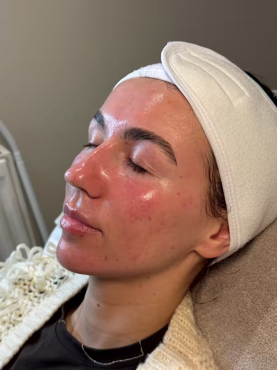 Skin treatment result — radiant complexion